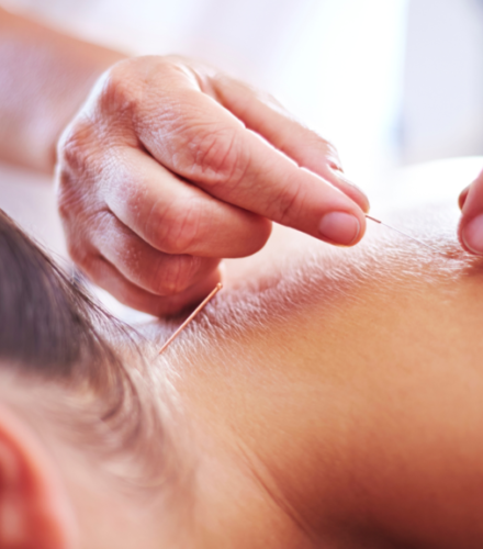 Acupuncture Acupuncture in Leigh and Warrington